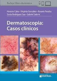 DERMATOSCOPIA - CASOS CLINICOS 