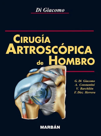 Cirugía Artroscópica del Hombro - Flexilibro