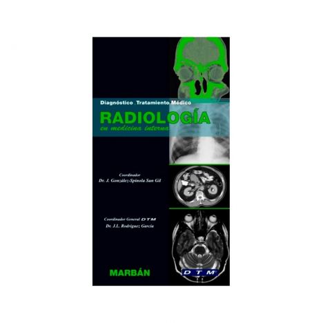 Radiología en Medicina Interna. Diagnóstico y Tratamiento Médico