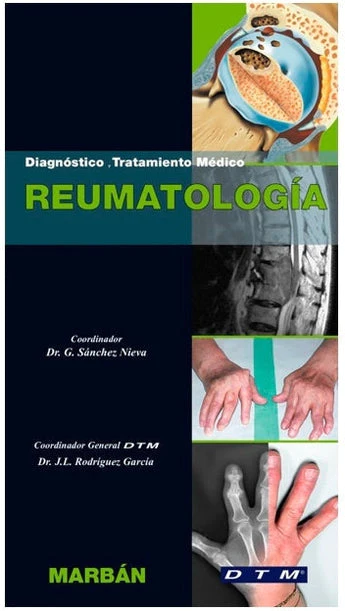 Reumatología Diagnóstico y Tratamiento Médico