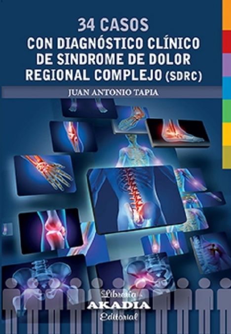 34 Casos con Diagnóstico Clínico de Síndrome de Dolor Regional Complejo