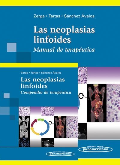 Las neoplasias linfoides Manual de terapéutica + Compendio de terapéutica
