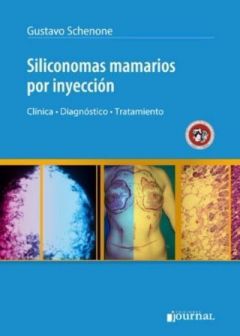 SILICONOMAS MAMARIOS POR INYECCION 