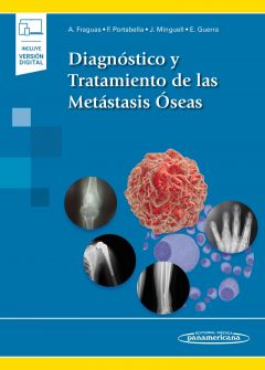 Diagnóstico y Tratamiento de las Metástasis Óseas + EBook